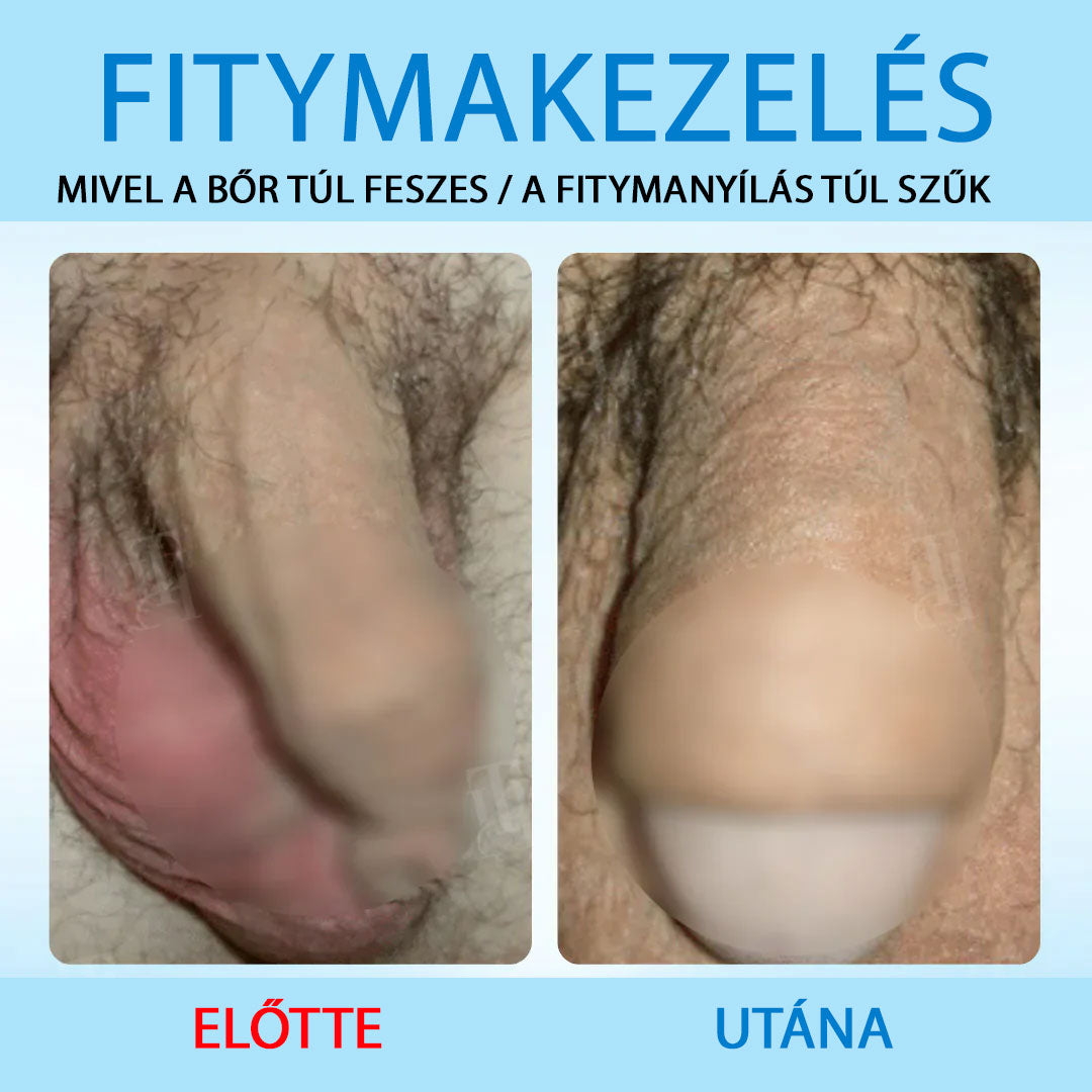 ✨ Fájdalmas Feszülésből Teljes Szabadság! | ⏱️ Érezze a Változást Mindössze 7 Nap Alatt! | RZXEA™ Prémium Rugalmasságnövelő Gél