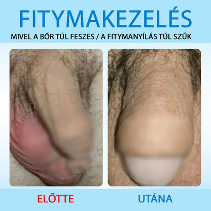 ✨ Fájdalmas Feszülésből Teljes Szabadság! | ⏱️ Érezze a Változást Mindössze 7 Nap Alatt! | RZXEA™ Prémium Rugalmasságnövelő Gél
