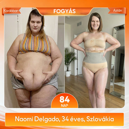 🍈🍈A márka hivatalos üzlete | 🍃RZXEA™  2026 Moringa és berberin 4 az 1-ben mikrorészecskés alakformáló és zsírégető rövidnadrág