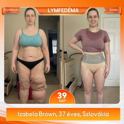 🍈🍈A márka hivatalos üzlete | 🍃RZXEA™  2026 Moringa és berberin 4 az 1-ben mikrorészecskés alakformáló és zsírégető rövidnadrág